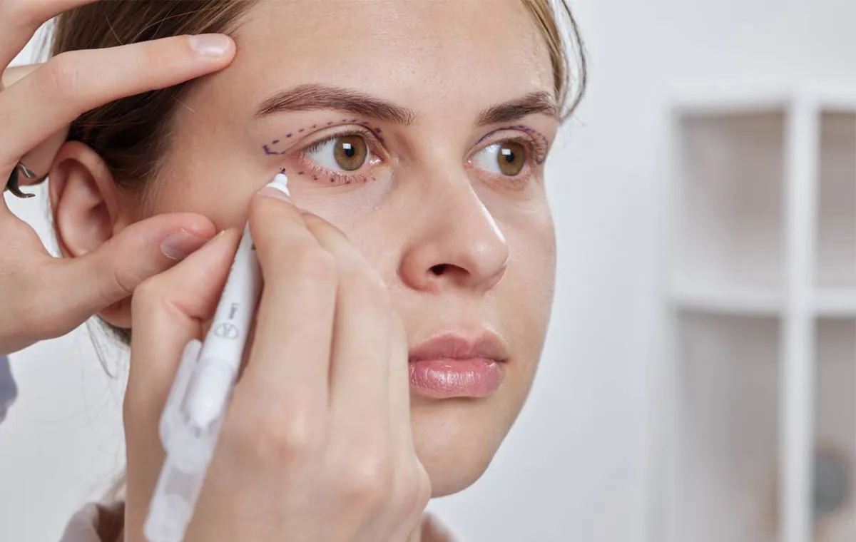 بهترین کرم برای جای بخیه پلک؛ راهنمای کامل محو اسکار