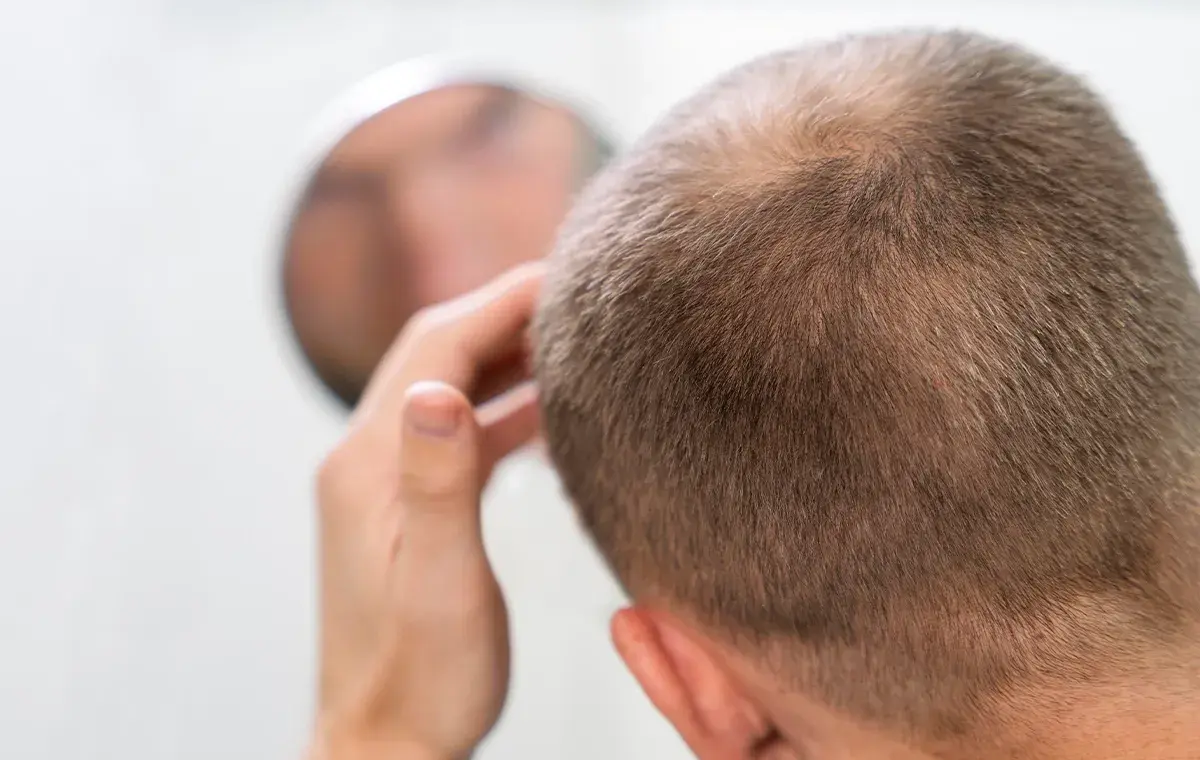 راهنمای جامع برای مراقبت و تقویت موهای کاشته‌شده با محصولات ژاک آندرل