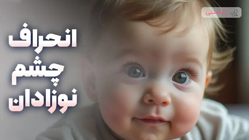 بررسی انحراف چشم نوزادان در ماه‌های اولیه زندگی