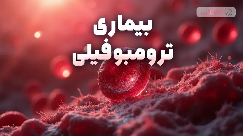 درمان ترومبوفیلی در زنان باردار و راهکارهای پیشگیری