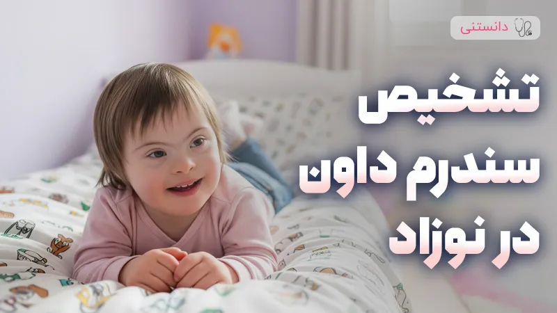 روش‌های تشخیص سندروم داون در نوزادان و اهمیت آن