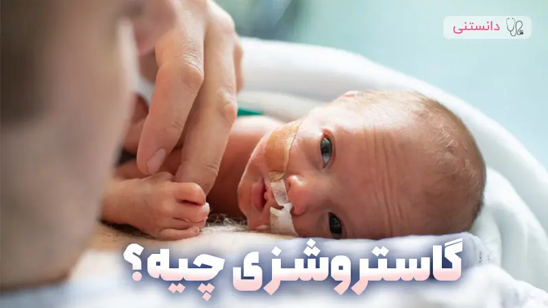 گاستروشزی چیست و چه تفاوتی با امفالوسل دارد
