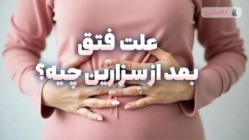 دلایل بروز فتق پس از سزارین و راهکارهای پیشگیری و درمان