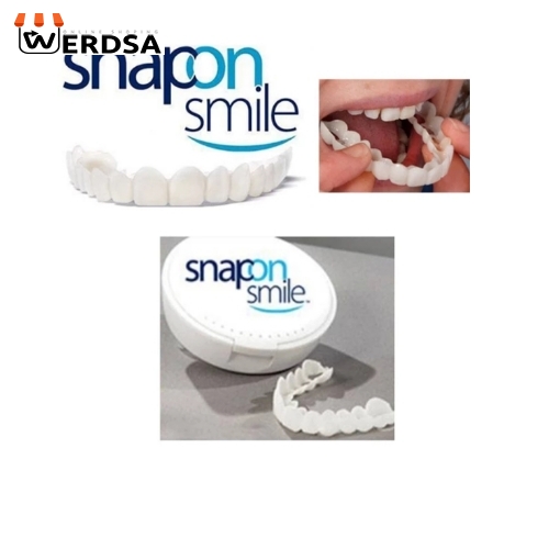 لمینت متحرک دندان دو فک snap on smile با جایزه ویژه عینک 300 هزار تومانیر