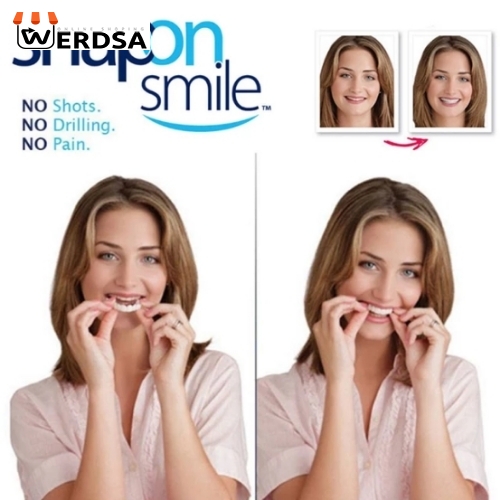 لمینت متحرک دندان دو فک snap on smile کد 1497 شرکتی اصلی