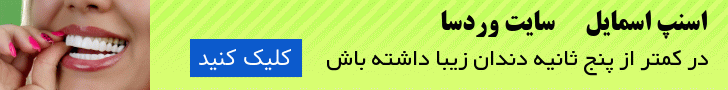 خرید لمینت متحرک دندان وردسا